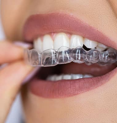 Ortodoncia Ortodoncia