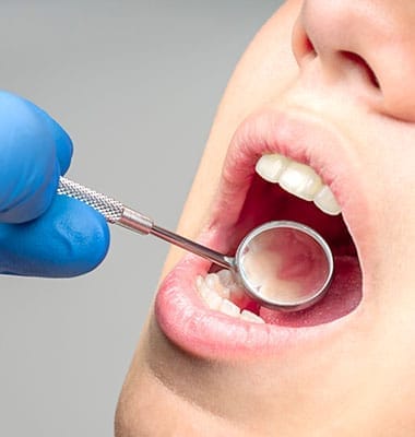 Prevención Bucal Prevención Bucal