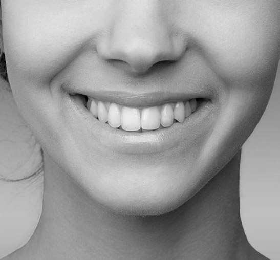 estetica-dental