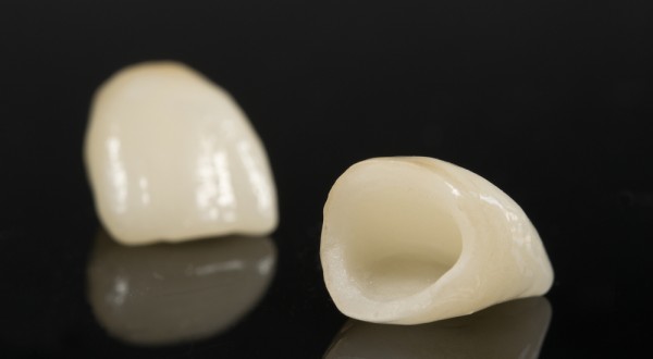 Corona-dental-600×330