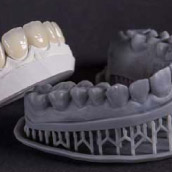 diseno-sonrisa
