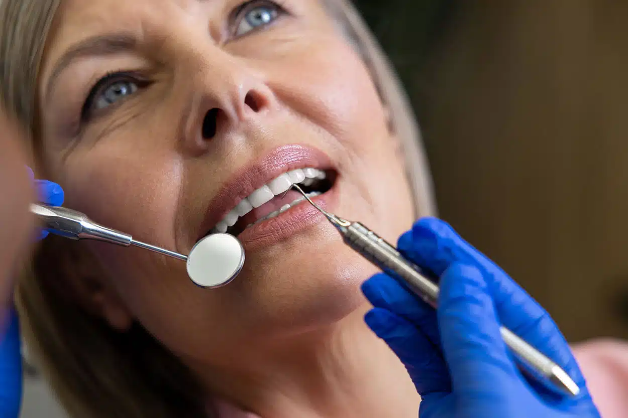 Rehabilitación Oral
