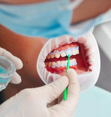 Estética Dental