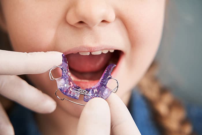 Disyuntor Dental Infantil Disyuntor Dental Infantil