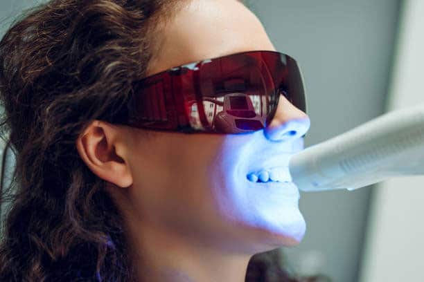 Blanqueamiento Dental Blanqueamiento Dental