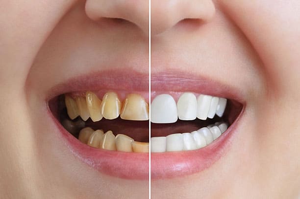 Cosmética Dental Cosmética Dental